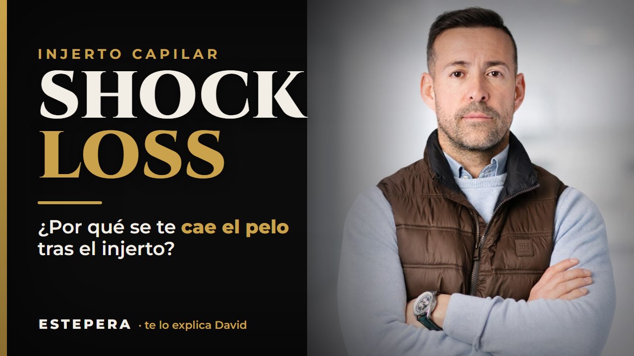Vídeo: qué es el shock loss tras un injerto capilar, explicado por David de ESTEPERA